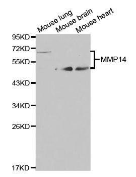 MMP14 antibody