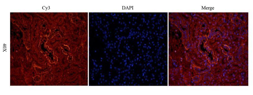 MMP15 antibody