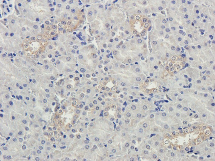 MMP15 antibody