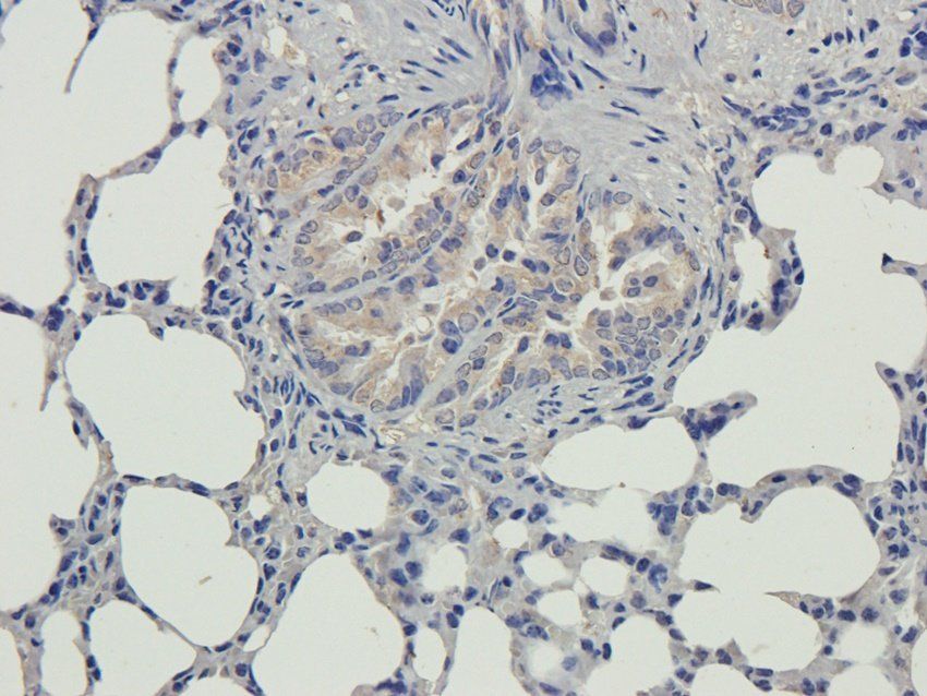 MMP15 antibody