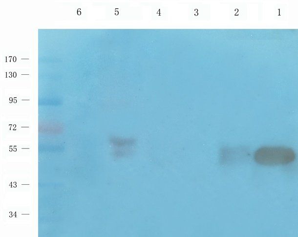 MMP15 antibody