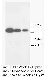 Anti-Matrix metalloproteinase-16 MMP16 Antibody