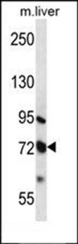 MMP17 antibody
