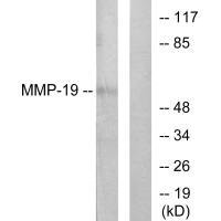 MMP19 antibody