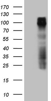 MMP2 Antibody