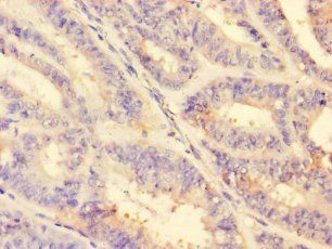 MMP2 Antibody