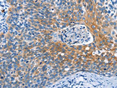 MMP2 Antibody
