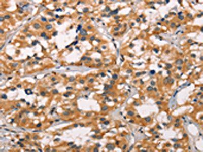 MMP2 Antibody