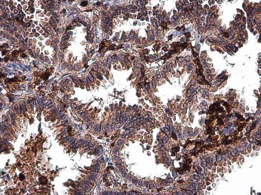MMP2 antibody