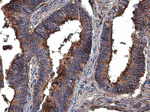 MMP2 antibody
