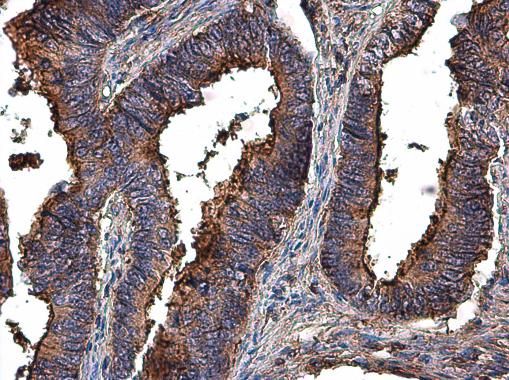 matrix metallopeptidase 2 Antibody