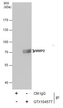 MMP2 antibody
