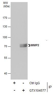 matrix metallopeptidase 2 Antibody