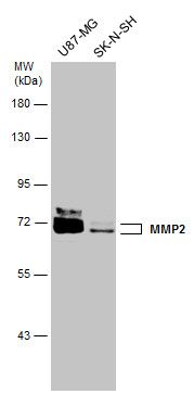 matrix metallopeptidase 2 Antibody