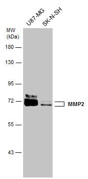 MMP2 antibody