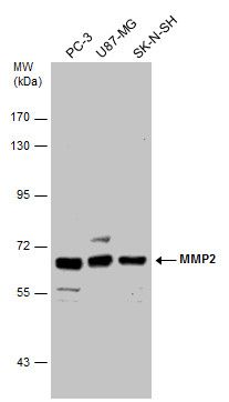 matrix metallopeptidase 2 Antibody