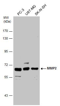 MMP2 antibody