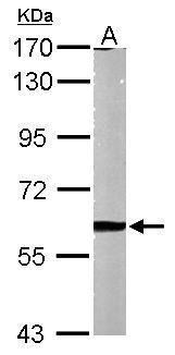 matrix metallopeptidase 2 Antibody