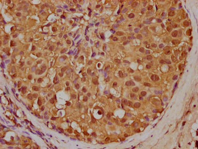 MMP2 Antibody