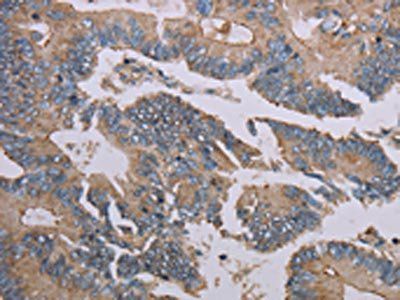 MMP20 Antibody
