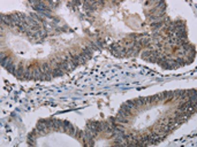 MMP20 Antibody