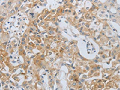 MMP25 Antibody
