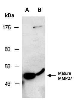 MMP27 (C) Antibody, Rabbit Polyclonal