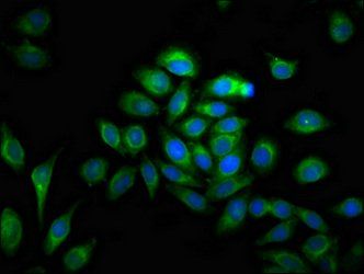 MMP28 Antibody