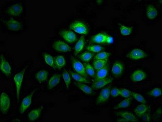 MMP28 antibody