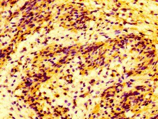 MMP28 Antibody