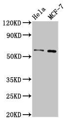 MMP28 antibody