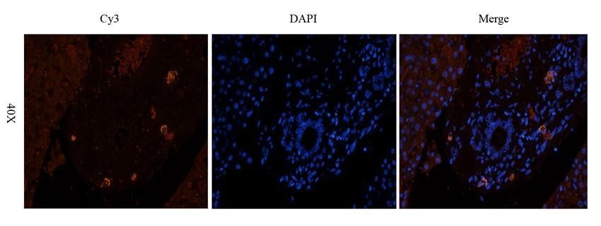 MMP3 antibody