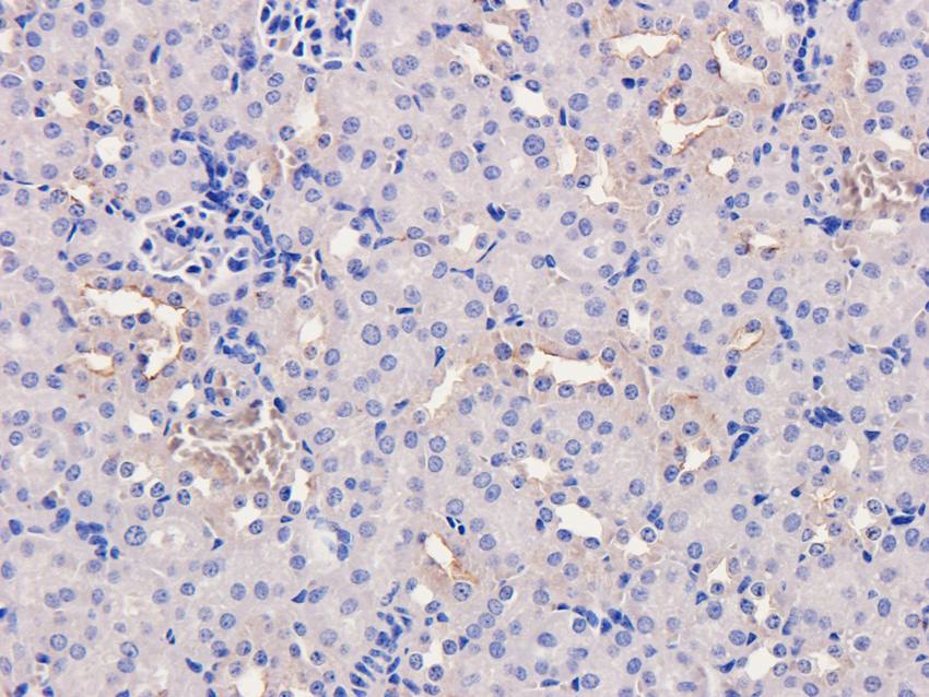 MMP3 antibody