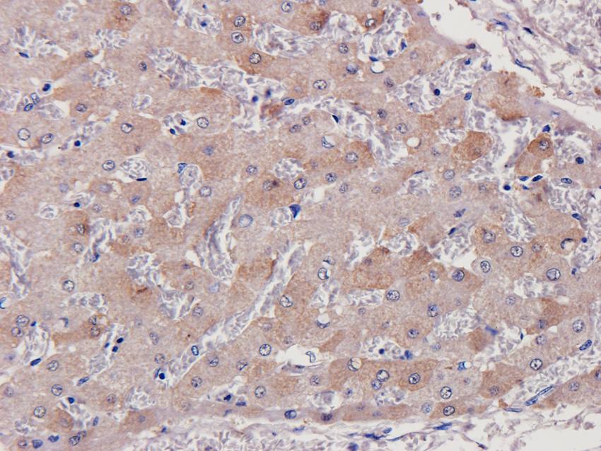 MMP3 antibody