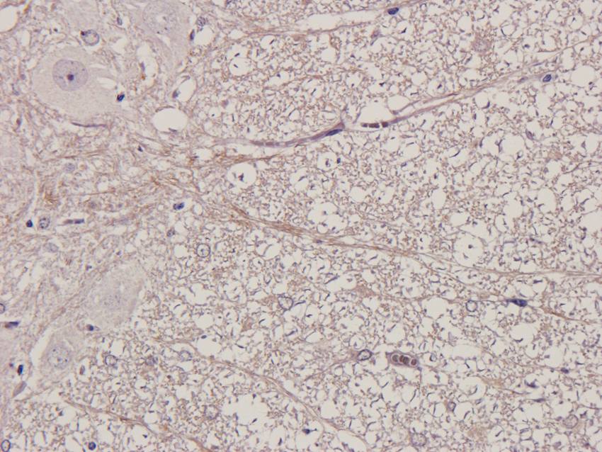 MMP3 antibody