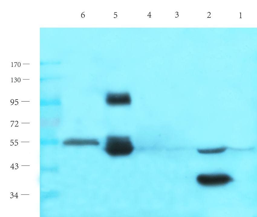 MMP3 antibody