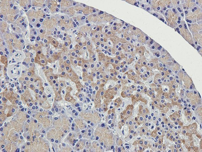 MMP7 antibody