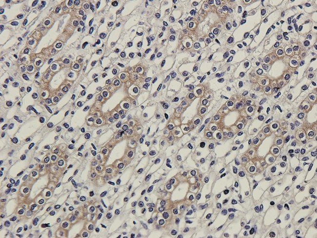 MMP7 antibody