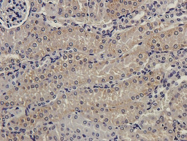 MMP7 antibody