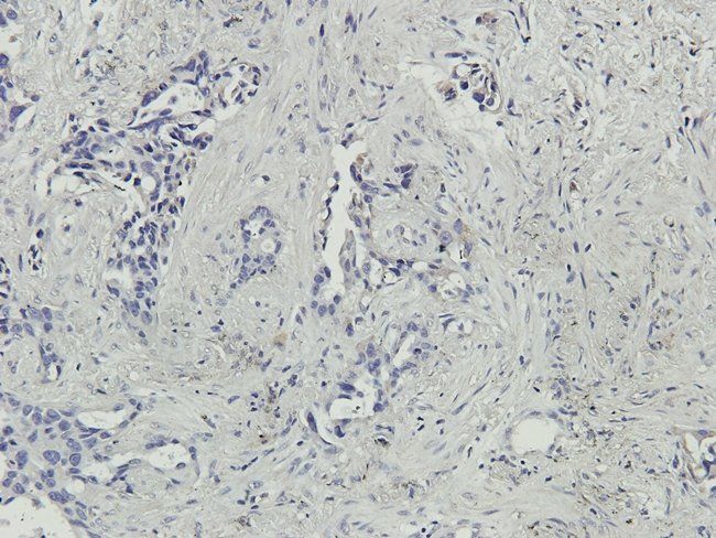 MMP7 antibody