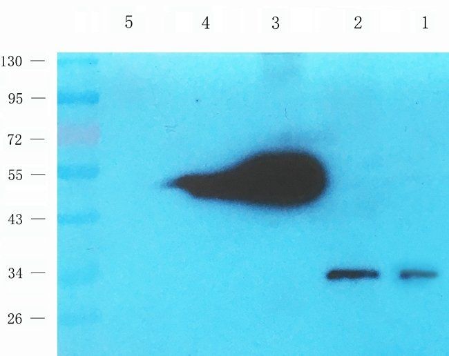 MMP7 antibody