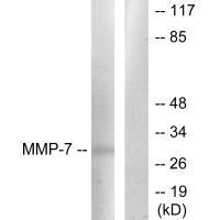 MMP7 antibody