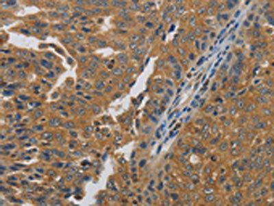 MMP8 Antibody