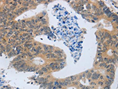 MMP8 Antibody