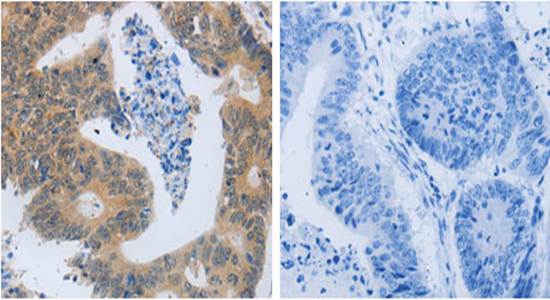 MMP8 Rabbit Polyclonal Antibody