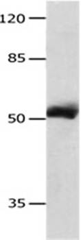 MMP8 Rabbit Polyclonal Antibody