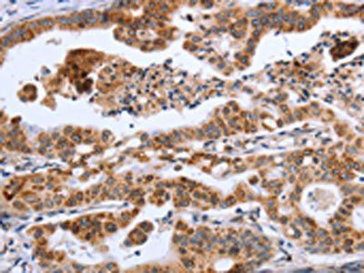 MMP9 Antibody