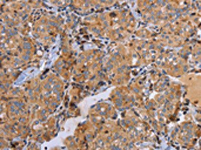 MMP9 Antibody