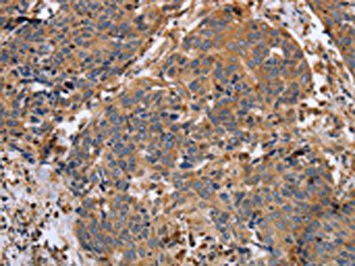 MMP9 Antibody