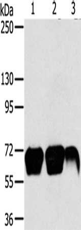 MMP9 Antibody